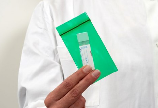 Ancona – Prevenzione del tumore del colon retto, iniziative di sensibilizzazione