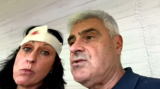 Giulianova-Ancona: giornalista dorica ferita alla testa durante radiovisione