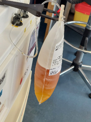Allarme sangue in Italia: scorte in difficoltà, appello per le donazioni di 0 positivo